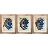 Anatomy Heart Dictionary Art Prints, Set of 3 Medical Wall Decor